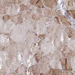 Invitrogen C5orf33 Polyclonal Antibody 100 &mu;L; Unconjugated:Antibodies,