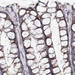 Invitrogen C5orf33 Polyclonal Antibody 100 &mu;L; Unconjugated:Antibodies,