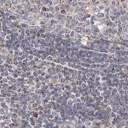 Invitrogen C5orf33 Polyclonal Antibody 100 &mu;L; Unconjugated:Antibodies,