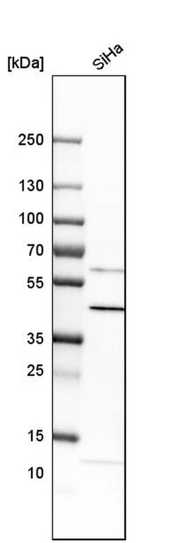 Invitrogen C5orf33 Polyclonal Antibody 100 &mu;L; Unconjugated:Antibodies,