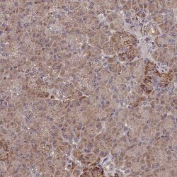 Invitrogen SUPV3L1 Polyclonal Antibody 100 &mu;L; Unconjugated:Antibodies,