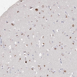 Invitrogen ARSI Polyclonal Antibody 100 &mu;L; Unconjugated:Antibodies,