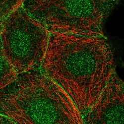 Invitrogen C11orf52 Polyclonal Antibody 100 &mu;L; Unconjugated:Antibodies,