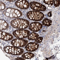 Invitrogen C11orf52 Polyclonal Antibody 100 &mu;L; Unconjugated:Antibodies,