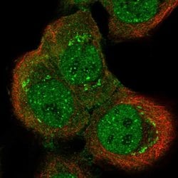 GRF-1 Polyclonal Antibody, Invitrogen 100 &mu;L; Unconjugated:Antibodies,