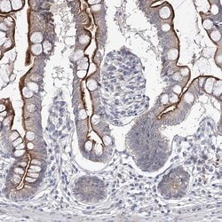 GRF-1 Polyclonal Antibody, Invitrogen 100 &mu;L; Unconjugated:Antibodies,
