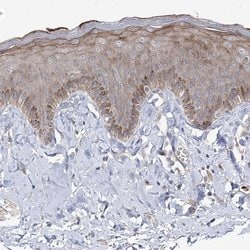 GRF-1 Polyclonal Antibody, Invitrogen 100 &mu;L; Unconjugated:Antibodies,