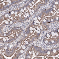 Invitrogen MTCH2 Polyclonal Antibody 100 &mu;L; Unconjugated:Antibodies,