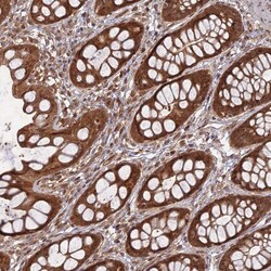 Invitrogen APC4 Polyclonal Antibody 100 &mu;L; Unconjugated:Antibodies,
