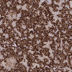 Invitrogen TGFBRAP1 Polyclonal Antibody 100 &mu;L; Unconjugated:Antibodies,