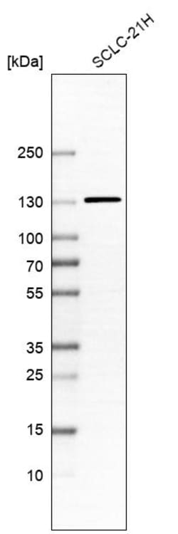 Invitrogen TGFBRAP1 Polyclonal Antibody 100 &mu;L; Unconjugated:Antibodies,