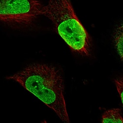 Invitrogen C10orf97 Polyclonal Antibody 100 &mu;L; Unconjugated:Antibodies,