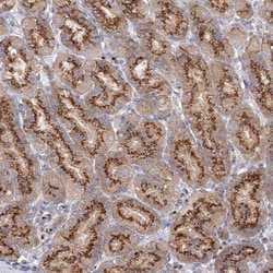 Invitrogen SEC23IP Polyclonal Antibody 100 &mu;L; Unconjugated:Antibodies,