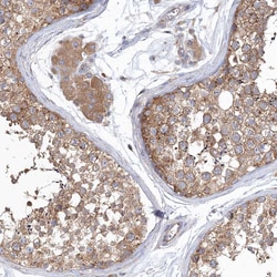 Invitrogen SEC23IP Polyclonal Antibody 100 &mu;L; Unconjugated:Antibodies,