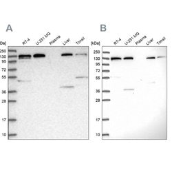 Invitrogen SEC23IP Polyclonal Antibody 100 &mu;L; Unconjugated:Antibodies,