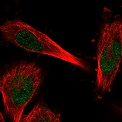 Invitrogen C11orf1 Polyclonal Antibody 100 &mu;L; Unconjugated:Antibodies,
