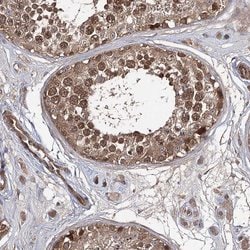 Invitrogen WDR48 Polyclonal Antibody 100 &mu;L; Unconjugated:Antibodies,