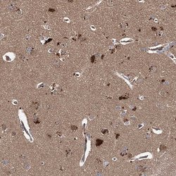 Invitrogen WDR48 Polyclonal Antibody 100 &mu;L; Unconjugated:Antibodies,