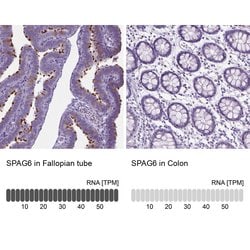 Invitrogen SPAG6 Polyclonal Antibody 100 &mu;L; Unconjugated:Antibodies,