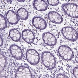 Invitrogen SPAG6 Polyclonal Antibody 100 &mu;L; Unconjugated:Antibodies,
