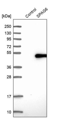 Invitrogen SPAG6 Polyclonal Antibody 100 &mu;L; Unconjugated:Antibodies,