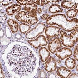 Invitrogen PPIP5K2 Polyclonal Antibody 100 &mu;L; Unconjugated:Antibodies,