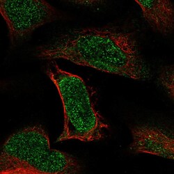 Invitrogen ATE1 Polyclonal Antibody 100 &mu;L; Unconjugated:Antibodies,