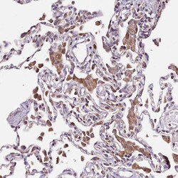 Invitrogen ATE1 Polyclonal Antibody 100 &mu;L; Unconjugated:Antibodies,