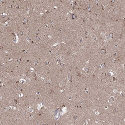 Invitrogen ARHGAP20 Polyclonal Antibody 100 &mu;L; Unconjugated:Antibodies,