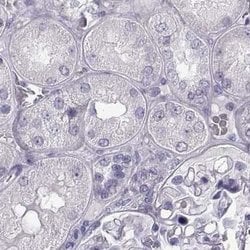Invitrogen BFSP2 Polyclonal Antibody 100 &mu;L; Unconjugated:Antibodies,
