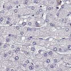 Invitrogen BFSP2 Polyclonal Antibody 100 &mu;L; Unconjugated:Antibodies,