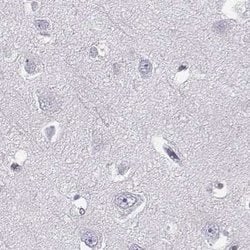 Invitrogen BFSP2 Polyclonal Antibody 100 &mu;L; Unconjugated:Antibodies,