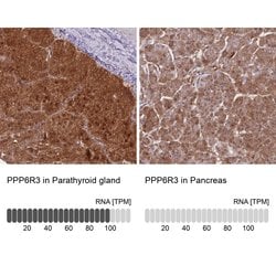 Invitrogen PPP6R3 Polyclonal Antibody 100 &mu;L; Unconjugated:Antibodies,