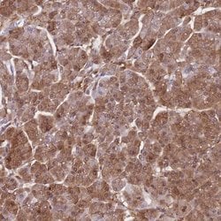 Invitrogen PPP6R3 Polyclonal Antibody 100 &mu;L; Unconjugated:Antibodies,