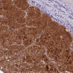 Invitrogen PPP6R3 Polyclonal Antibody 100 &mu;L; Unconjugated:Antibodies,