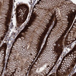 Invitrogen RASSF3 Polyclonal Antibody 100 &mu;L; Unconjugated:Antibodies,