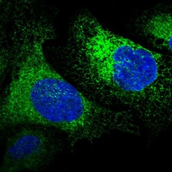 Invitrogen RCN1 Polyclonal Antibody 100 &mu;L; Unconjugated:Antibodies,