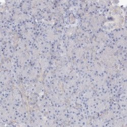 Invitrogen RCN1 Polyclonal Antibody 100 &mu;L; Unconjugated:Antibodies,