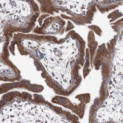 Invitrogen RCN1 Polyclonal Antibody 100 &mu;L; Unconjugated:Antibodies,