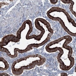 Invitrogen RCN1 Polyclonal Antibody 100 &mu;L; Unconjugated:Antibodies,