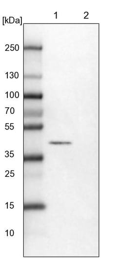 Invitrogen RCN1 Polyclonal Antibody 100 &mu;L; Unconjugated:Antibodies,