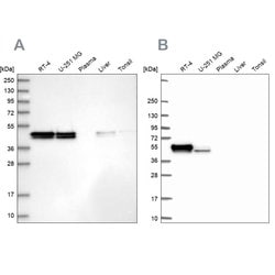 Invitrogen RCN1 Polyclonal Antibody 100 &mu;L; Unconjugated:Antibodies,