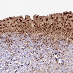 Invitrogen Cerebral Protein 1 Polyclonal Antibody 100 &mu;L; Unconjugated:Antibodies,