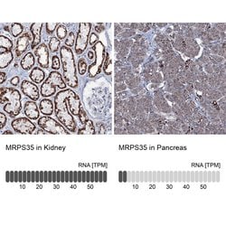 Invitrogen MRPS35 Polyclonal Antibody 100 &mu;L; Unconjugated:Antibodies,