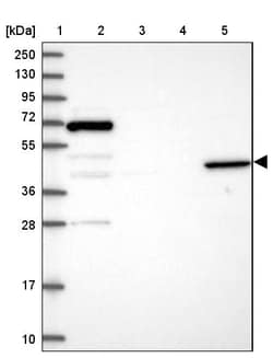 Invitrogen ANGPTL5 Polyclonal Antibody 100 &mu;L | Buy Online | Invitrogen&trade; | Fisher Scientific