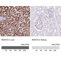 Invitrogen RDH16 Polyclonal Antibody 100 &mu;L; Unconjugated:Antibodies,