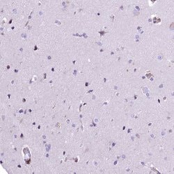 Invitrogen RDH16 Polyclonal Antibody 100 &mu;L; Unconjugated:Antibodies,