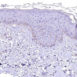 Invitrogen RDH16 Polyclonal Antibody 100 &mu;L; Unconjugated:Antibodies,