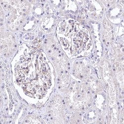 Invitrogen RDH16 Polyclonal Antibody 100 &mu;L; Unconjugated:Antibodies,