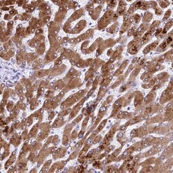 Invitrogen RDH16 Polyclonal Antibody 100 &mu;L; Unconjugated:Antibodies,